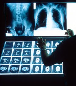 7fcda47071ee2ab8d070895e7312ddbc--radiology-healthy-life