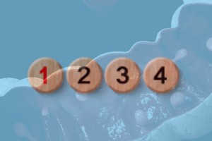 vastagbél daganat stádiumok